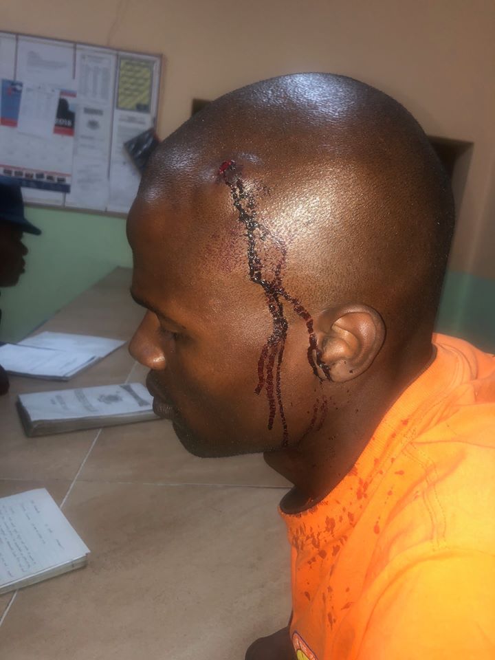 Graciano Chiweza who was assaulted &nearly abducted at Kamfinsa shopping center