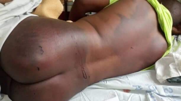 violent beating ... Noah Sahombe showing off his injuries before his death